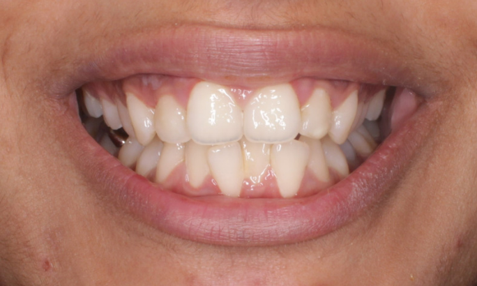 Before - Sky Dental